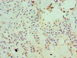 Immunohistochemistry (Formalin/PFA-fixed paraffin-embedded sections) - Anti-SLC20A2/PIT2 antibody (AB238337)