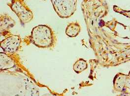 Immunohistochemistry (Formalin/PFA-fixed paraffin-embedded sections) - Anti-SLC20A2/PIT2 antibody (AB238337), expandable thumbnail