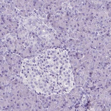 Immunohistochemistry (Formalin/PFA-fixed paraffin-embedded sections) - Anti-SLC22A2 antibody [CL0628] (AB242317), expandable thumbnail