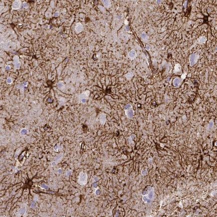 Immunohistochemistry (Formalin/PFA-fixed paraffin-embedded sections) - Anti-SLC22A2 antibody [CL0628] (AB242317), expandable thumbnail
