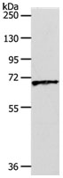 Western blot - Anti-SLC22A3/OCT3 antibody (AB183071), expandable thumbnail