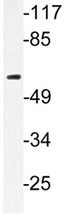 Western blot - Anti-SLC22A6 antibody (AB135924)
