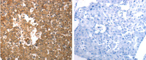 Immunohistochemistry (Formalin/PFA-fixed paraffin-embedded sections) - Anti-SLC22A6 antibody - C-terminal (AB183086)