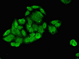 Immunocytochemistry/ Immunofluorescence - Anti-Slc25a1 antibody (AB236320), expandable thumbnail