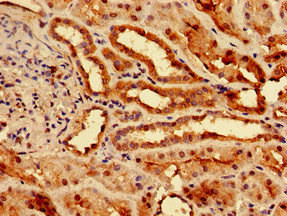 Immunohistochemistry (Formalin/PFA-fixed paraffin-embedded sections) - Anti-Slc25a1 antibody (AB236320), expandable thumbnail