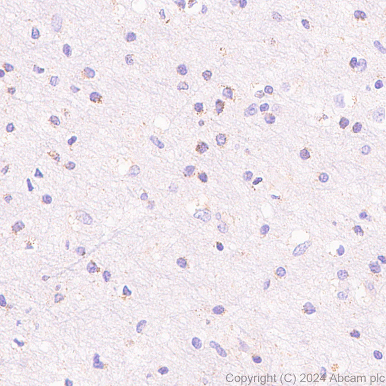 Immunohistochemistry (Formalin/PFA-fixed paraffin-embedded sections) - Anti-Slc25a1 antibody [EPR29193-92] (AB318201)