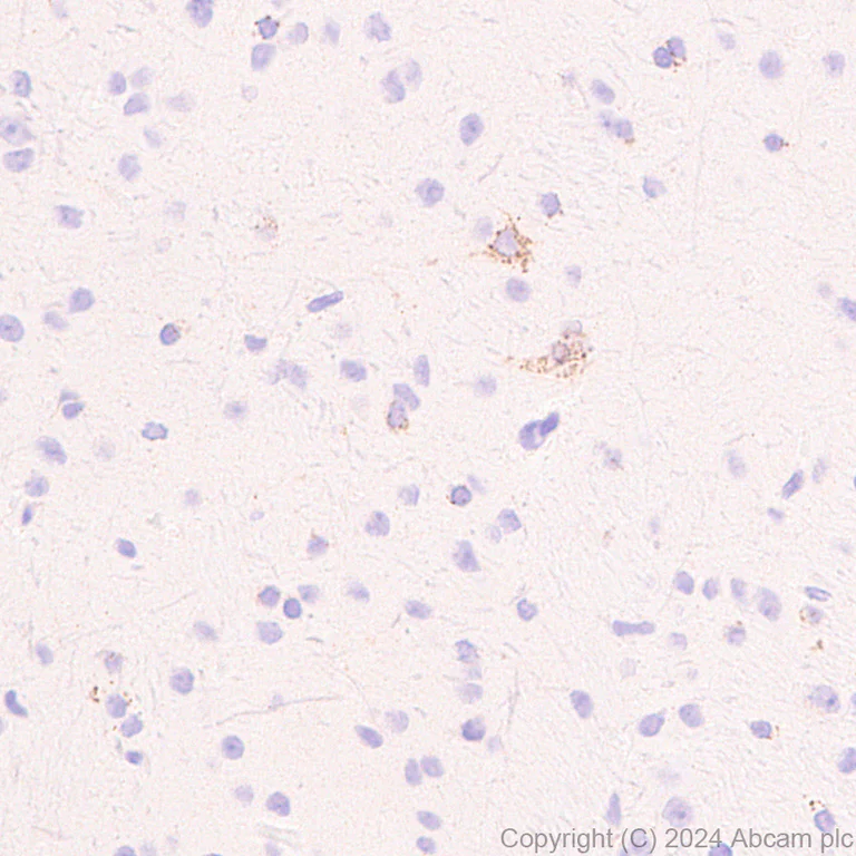 Immunohistochemistry (Formalin/PFA-fixed paraffin-embedded sections) - Anti-Slc25a1 antibody [EPR29193-92] (AB318201)