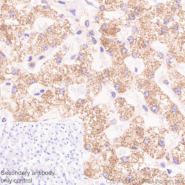Immunohistochemistry (Formalin/PFA-fixed paraffin-embedded sections) - Anti-Slc25a1 antibody [EPR29193-92] - BSA and Azide free (AB318202)