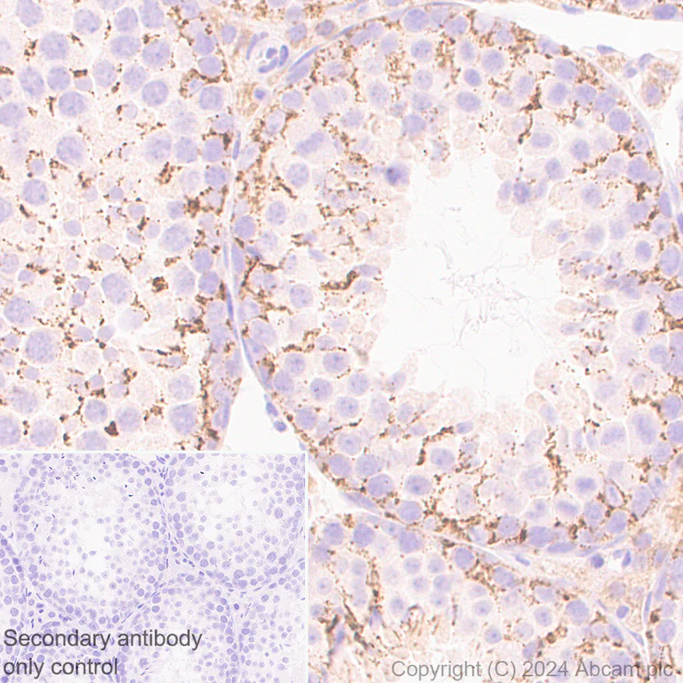 Immunohistochemistry (Formalin/PFA-fixed paraffin-embedded sections) - Anti-Slc25a1 antibody [EPR29193-92] - BSA and Azide free (AB318202)