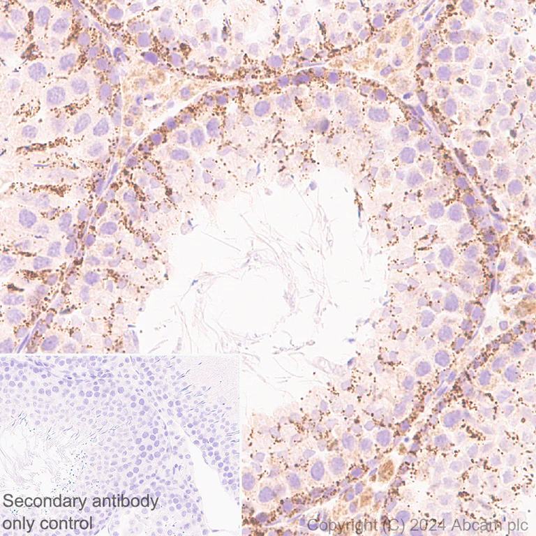 Immunohistochemistry (Formalin/PFA-fixed paraffin-embedded sections) - Anti-Slc25a1 antibody [EPR29193-92] - BSA and Azide free (AB318202)