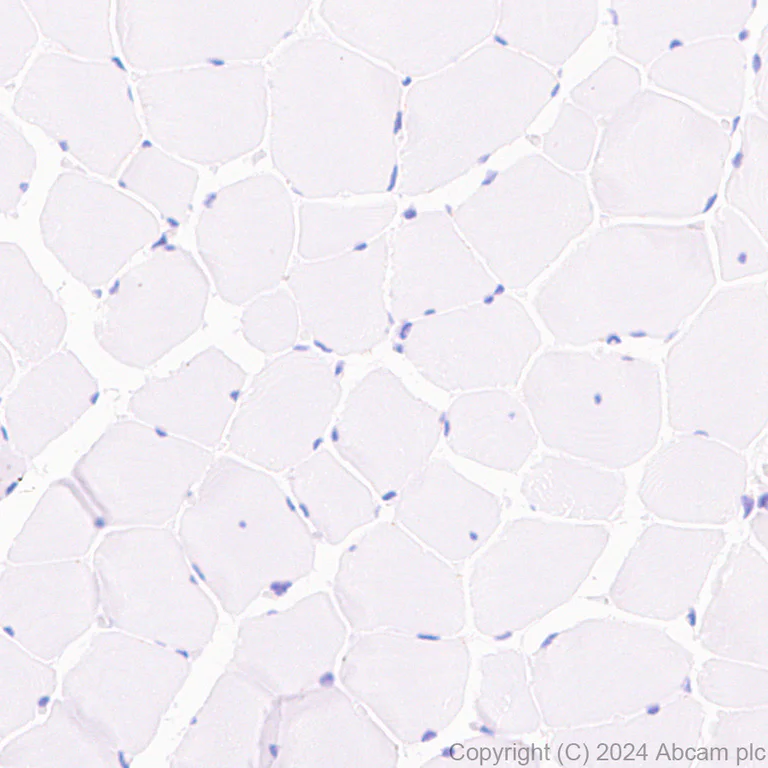 Immunohistochemistry (Formalin/PFA-fixed paraffin-embedded sections) - Anti-Slc25a1 antibody [EPR29193-92] - BSA and Azide free (AB318202)