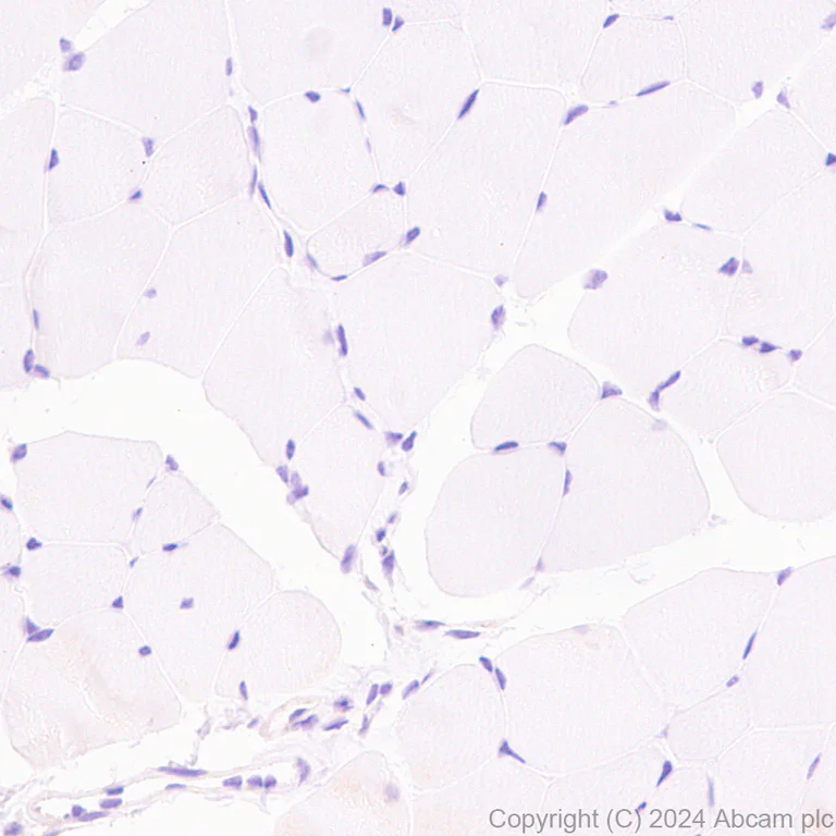 Immunohistochemistry (Formalin/PFA-fixed paraffin-embedded sections) - Anti-Slc25a1 antibody [EPR29193-92] - BSA and Azide free (AB318202)