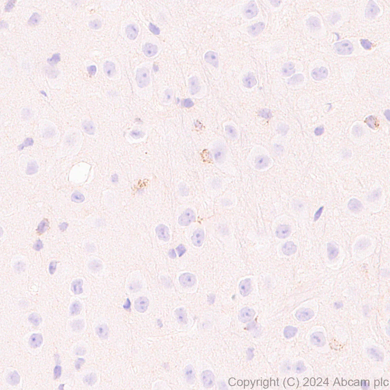 Immunohistochemistry (Formalin/PFA-fixed paraffin-embedded sections) - Anti-Slc25a1 antibody [EPR29193-92] - BSA and Azide free (AB318202)