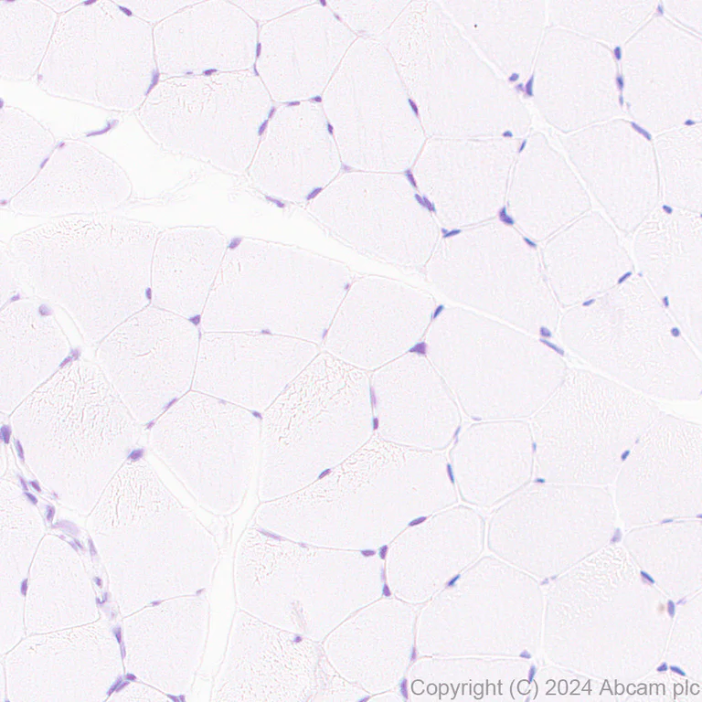 Immunohistochemistry (Formalin/PFA-fixed paraffin-embedded sections) - Anti-Slc25a1 antibody [EPR29193-92] - BSA and Azide free (AB318202)