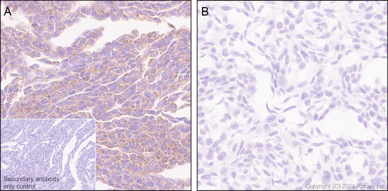 Immunohistochemistry (Formalin/PFA-fixed paraffin-embedded sections) - Anti-Slc25a1 antibody [EPR29193-92] - BSA and Azide free (AB318202)
