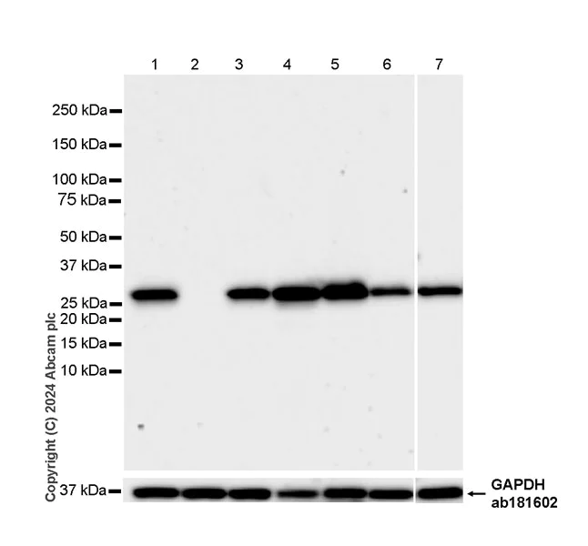 Western blot - Anti-Slc25a1 antibody [EPR29193-92] - BSA and Azide free (AB318202)