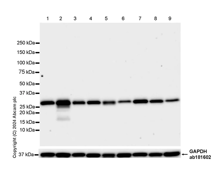 Western blot - Anti-Slc25a1 antibody [EPR29193-92] - BSA and Azide free (AB318202)