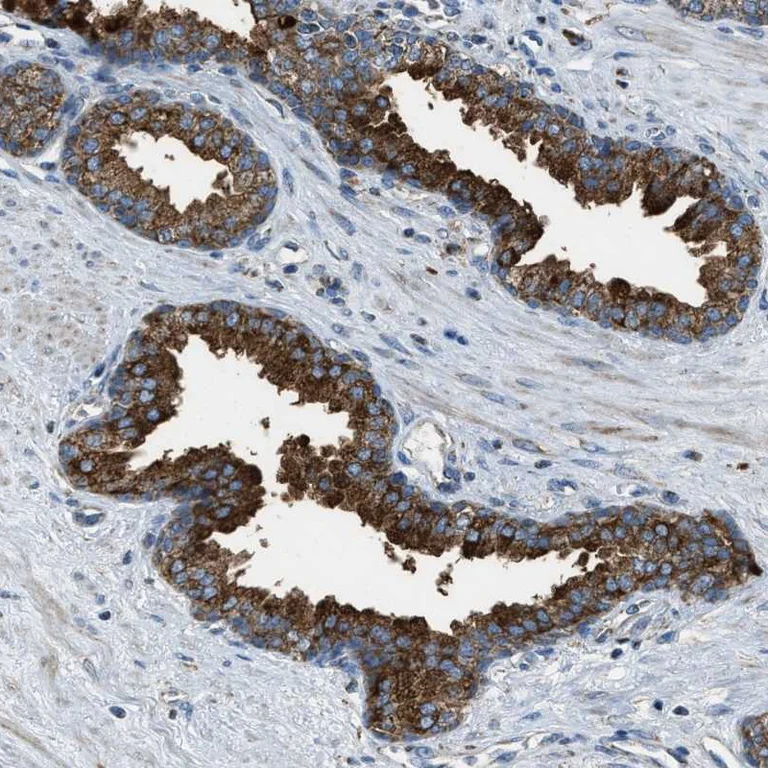 Immunohistochemistry (Formalin/PFA-fixed paraffin-embedded sections) - Anti-SLC25A11 antibody (AB272588)