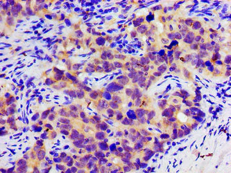 Immunohistochemistry (Formalin/PFA-fixed paraffin-embedded sections) - Anti-SLC25A12 antibody (AB234975)
