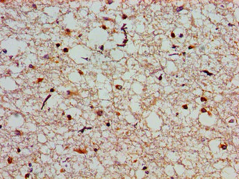 Immunohistochemistry (Formalin/PFA-fixed paraffin-embedded sections) - Anti-SLC25A12 antibody (AB234975)