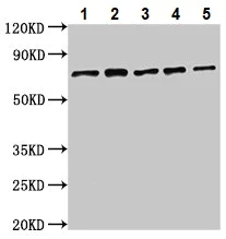 Western blot - Anti-SLC25A12 antibody (AB234975)