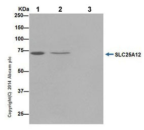 Immunoprecipitation - Anti-SLC25A12 antibody [EPR16294] - BSA and Azide free (AB246329), expandable thumbnail