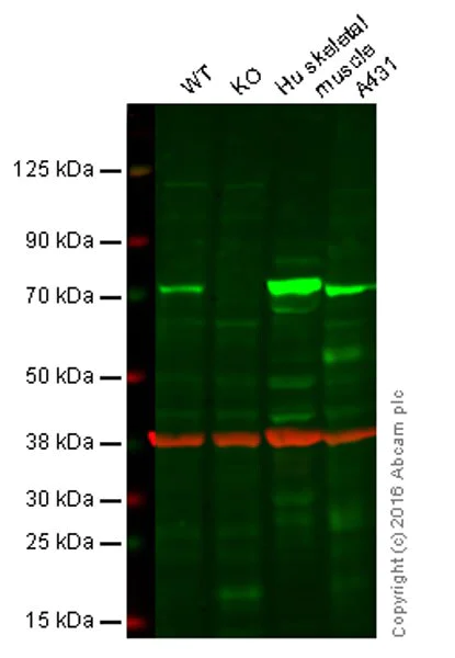 Western blot - Anti-SLC25A12 antibody [EPR16294] - BSA and Azide free (AB246329)