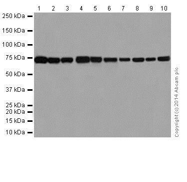 Western blot - Anti-SLC25A12 antibody [EPR16294] - BSA and Azide free (ab246329), expandable thumbnail