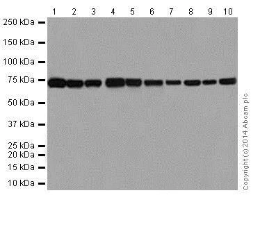 Western blot - Anti-SLC25A12 antibody [EPR16294] - BSA and Azide free (AB246329)