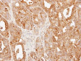 Immunohistochemistry (Formalin/PFA-fixed paraffin-embedded sections) - Anti-SLC25A13/Citrin antibody (AB96303)