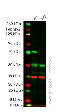 Western blot - Anti-SLC25A13/Citrin antibody [EPR9969(B)] (AB167166), expandable thumbnail