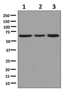 Western blot - Anti-SLC25A13/Citrin antibody [EPR9969(B)] (AB167166)