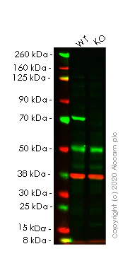 Western blot - Anti-SLC25A13/Citrin antibody [EPR9969(B)] - BSA and Azide free (AB249408)