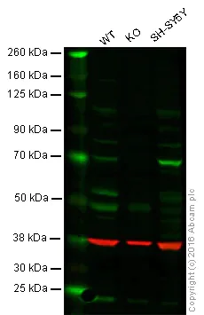 Western blot - Anti-SLC25A13/Citrin antibody [EPR9969(B)] - BSA and Azide free (AB249408)