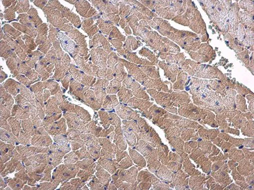 Immunohistochemistry (Formalin/PFA-fixed paraffin-embedded sections) - Anti-SLC25A15 antibody (AB228604)