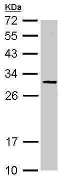 Western blot - Anti-SLC25A15 antibody (AB228604)