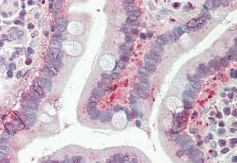 Immunohistochemistry (Formalin/PFA-fixed paraffin-embedded sections) - Anti-SLC25A19 antibody - C-terminal (AB190228)