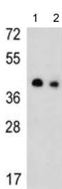 Western blot - Anti-SLC25A19 antibody - C-terminal (AB190228)