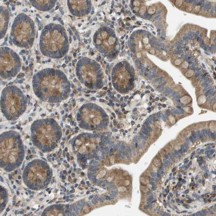 Immunohistochemistry (Formalin/PFA-fixed paraffin-embedded sections) - Anti-SLC25A20 antibody (AB224388)