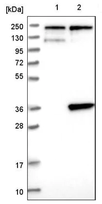 Western blot - Anti-SLC25A20 antibody (AB224388)