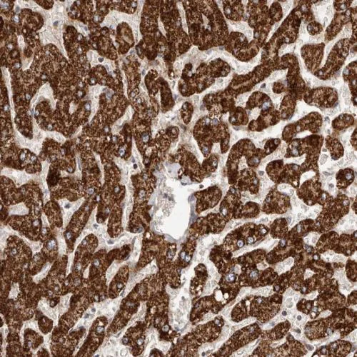 Immunohistochemistry (Formalin/PFA-fixed paraffin-embedded sections) - Anti-SLC25A20 antibody (AB244436)
