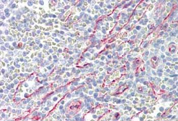 Immunohistochemistry (Formalin/PFA-fixed paraffin-embedded sections) - Anti-SLC25A21/ODC antibody (AB167033)