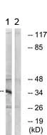 Western blot - Anti-SLC25A21/ODC antibody (AB167033)