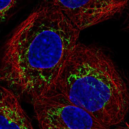 Immunocytochemistry/ Immunofluorescence - Anti-SLC25A24 antibody (AB221120), expandable thumbnail