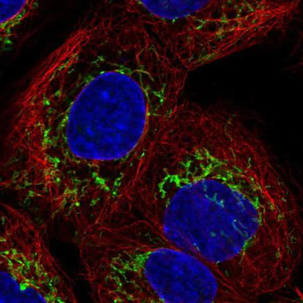 Immunocytochemistry/ Immunofluorescence - Anti-SLC25A24 antibody (AB221120)