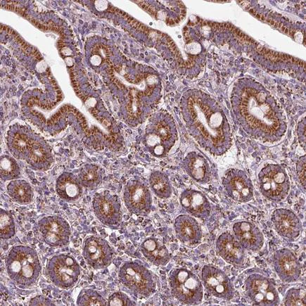 Immunohistochemistry (Formalin/PFA-fixed paraffin-embedded sections) - Anti-SLC25A24 antibody (AB221120)