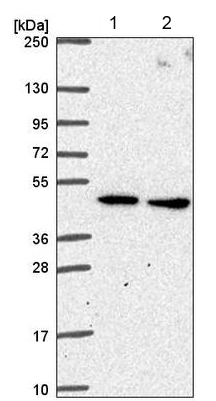 Western blot - Anti-SLC25A24 antibody (AB221120), expandable thumbnail