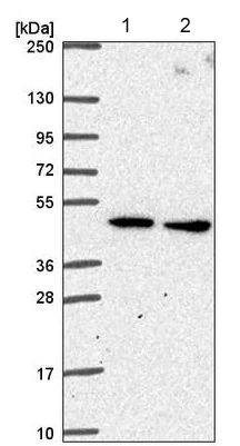 Western blot - Anti-SLC25A24 antibody (AB221120)
