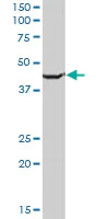 Western blot - Anti-SLC25A24 antibody (AB68796)