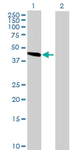 Western blot - Anti-SLC25A24 antibody (AB68796)